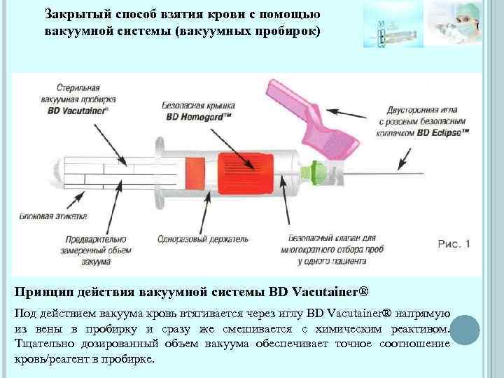 Закрытый способ взятия крови с помощью вакуумной системы (вакуумных пробирок) Принцип действия вакуумной системы