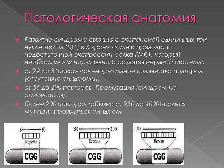 Патологическая анатомия Развитие синдрома связано с экспансией единичных три нуклеотидов (ЦГГ) в Х хромосоме