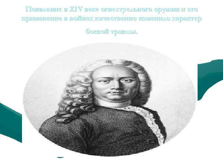 Появление в XIV веке огнестрельного оружия и его применение в войнах качественно изменило характер