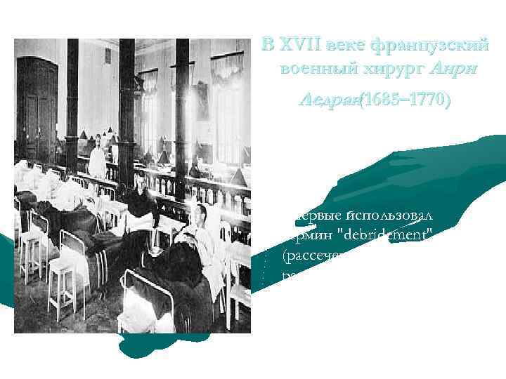 В XVII веке французский военный хирург Анри Ледран (1685– 1770) Впервые использовал термин "debridement"