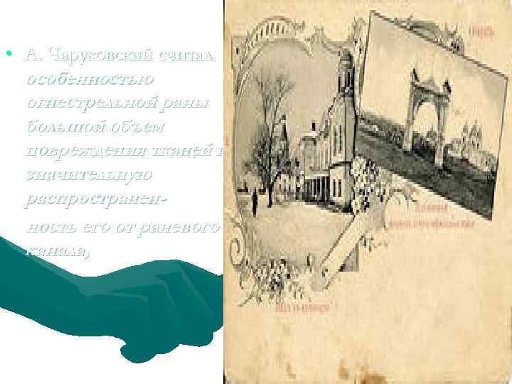  • А. Чаруковский считал особенностью огнестрельной раны большой объем повреждения тканей и значительную