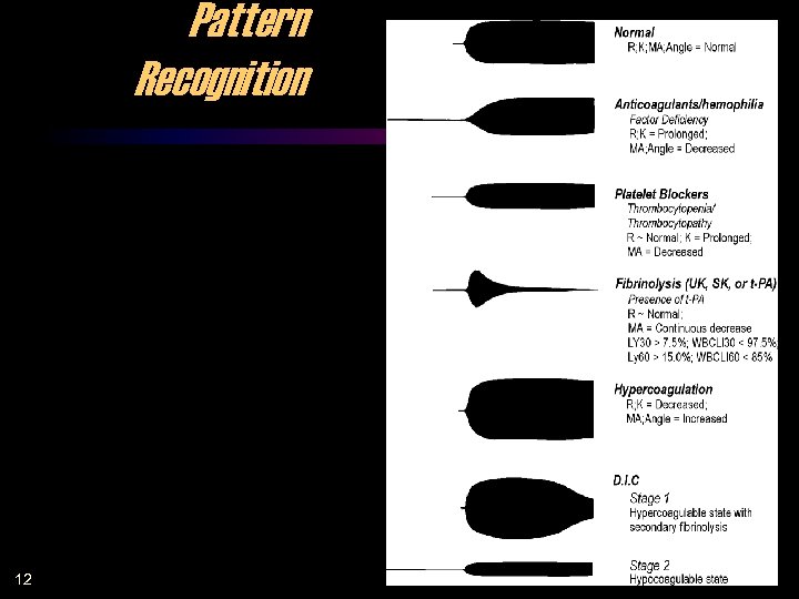 Pattern Recognition 12 