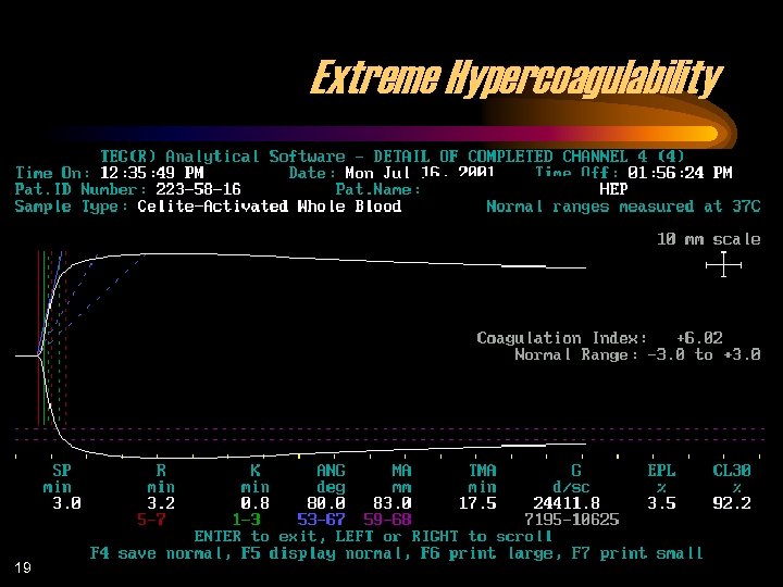 Extreme Hypercoagulability 19 