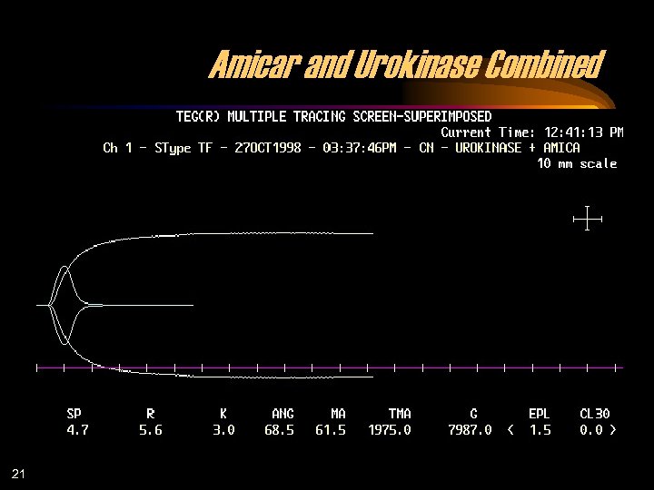 Amicar and Urokinase Combined 21 