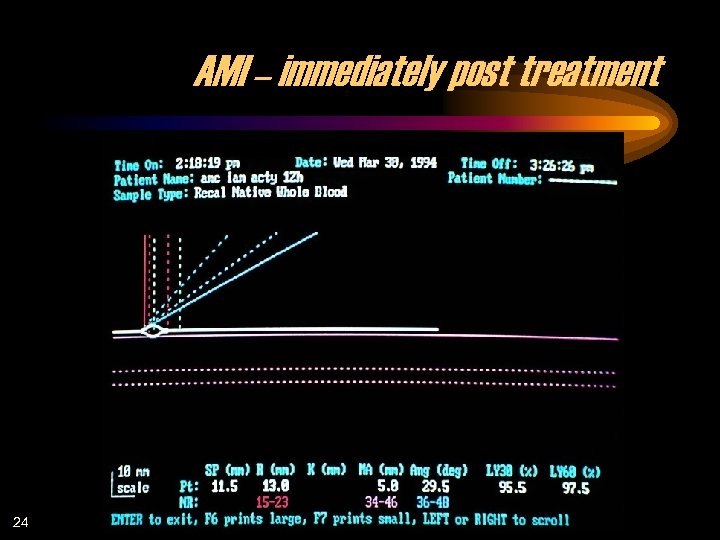 AMI – immediately post treatment 24 