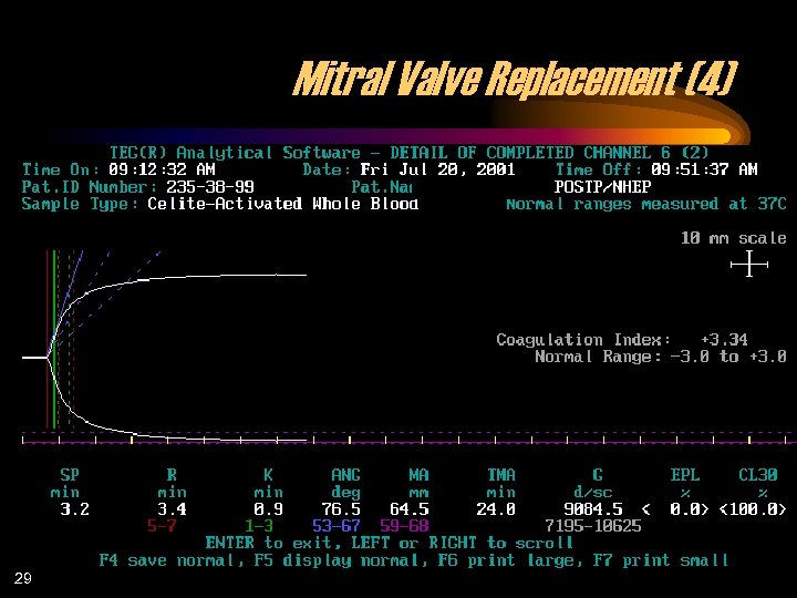 Mitral Valve Replacement (4) 29 