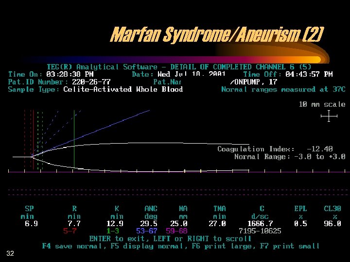 Marfan Syndrome/Aneurism (2) 32 