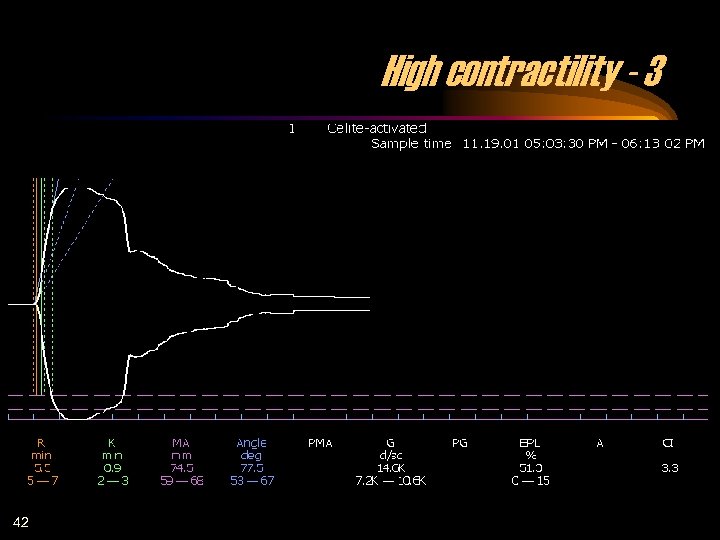 High contractility - 3 42 