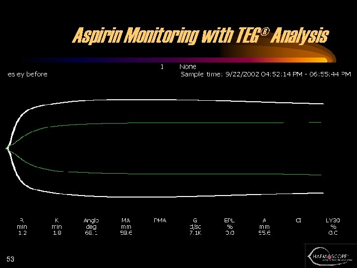 Aspirin Monitoring with TEG® Analysis 53 
