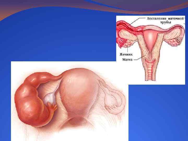 Картинка матка и маточные трубы