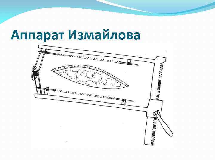 Аппарат Измайлова 