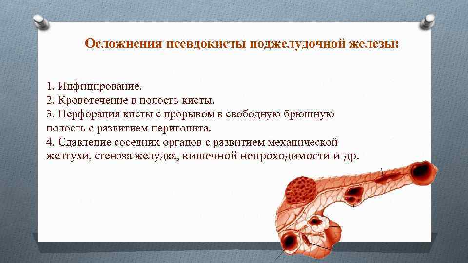 Осложнения псевдокисты поджелудочной железы: 1. Инфицирование. 2. Кровотечение в полость кисты. 3. Перфорация кисты