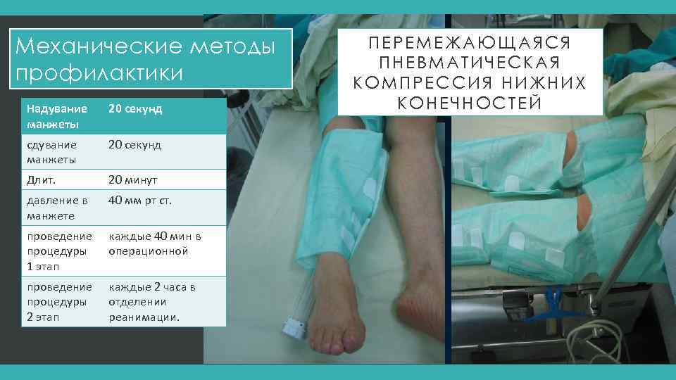 Механические методы профилактики Надувание манжеты 20 секунд сдувание манжеты 20 секунд Длит. 20 минут