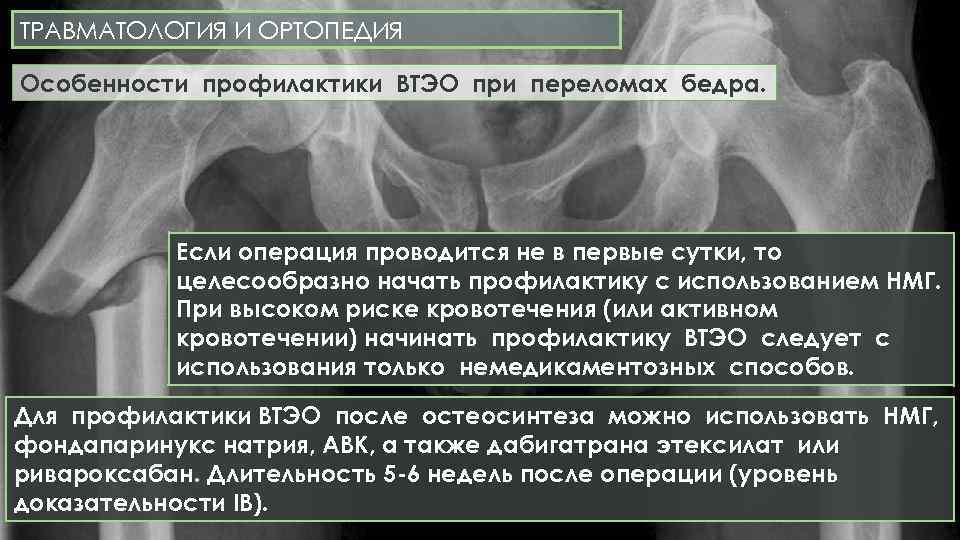 ТРАВМАТОЛОГИЯ И ОРТОПЕДИЯ Особенности профилактики ВТЭО при переломах бедра. Если операция проводится не в