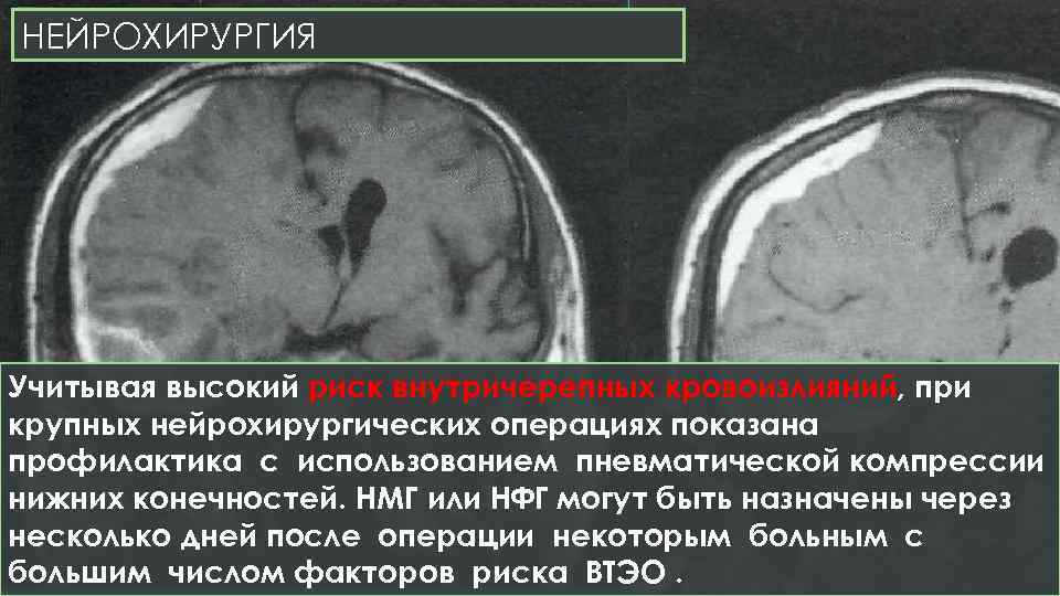 Тэла презентация хирургия