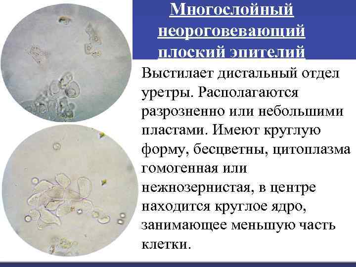 Многослойный неороговевающий плоский эпителий Выстилает дистальный отдел уретры. Располагаются разрозненно или небольшими пластами. Имеют