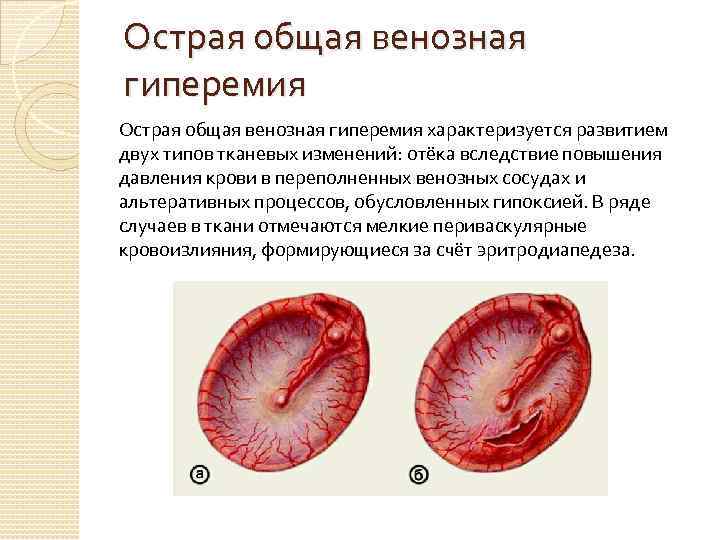 Гиперемия при диаскинтесте фото