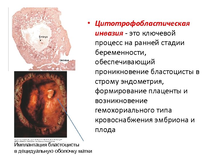  • Цитотрофобластическая инвазия - это ключевой процесс на ранней стадии беременности, обеспечивающий проникновение