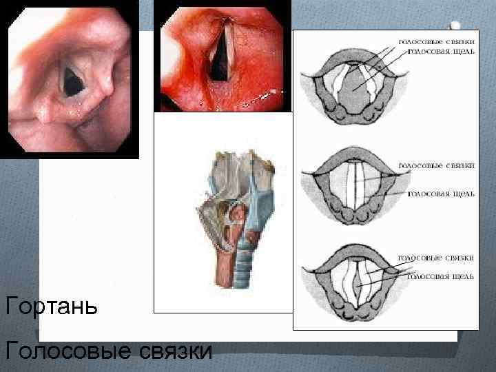 Гортань Голосовые связки 