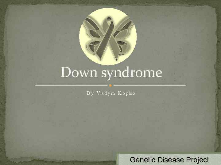 Down syndrome By Vadym Kopko Genetic Disease Project 