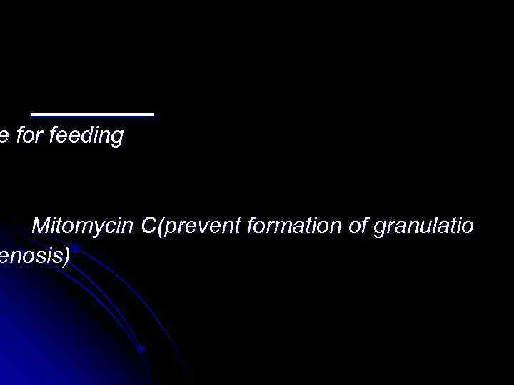 e for feeding Mitomycin C(prevent formation of granulatio enosis) 