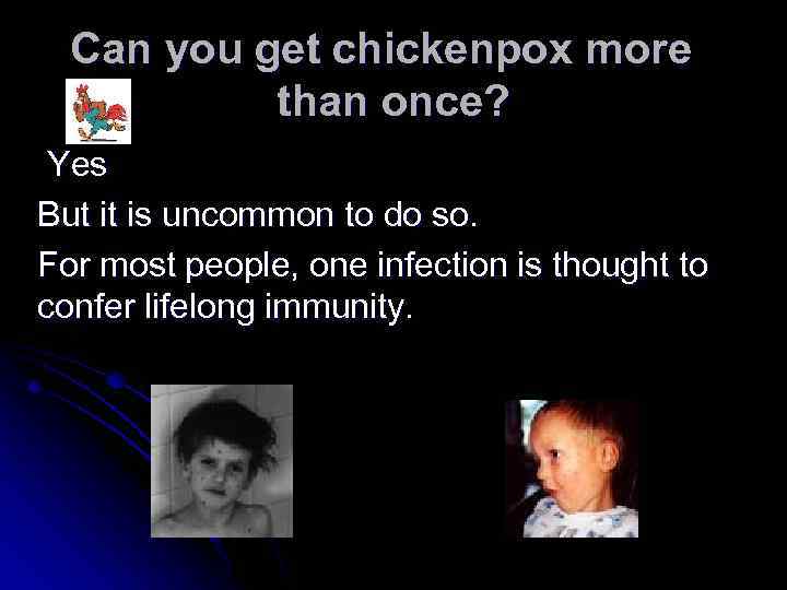 Can you get chickenpox more than once? Yes But it is uncommon to do
