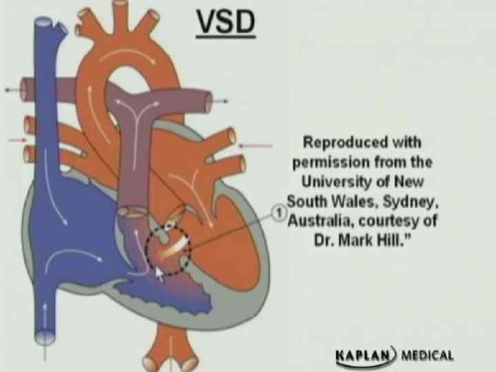 Congenital Heart Disease 