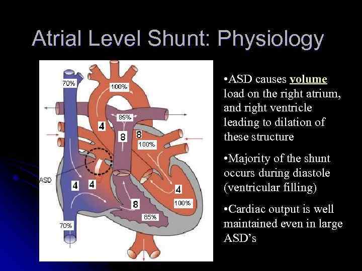 Atrial Level Shunt: Physiology • ASD causes volume load on the right atrium, and