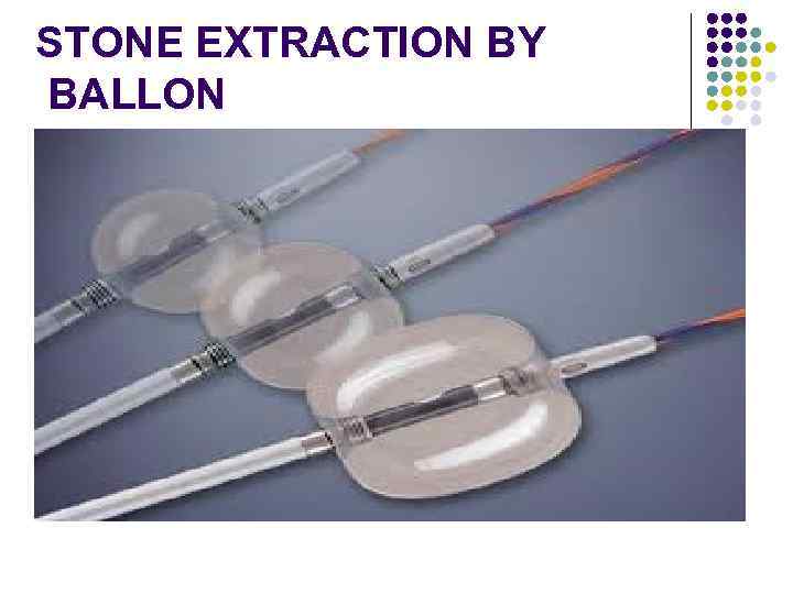 STONE EXTRACTION BY BALLON 