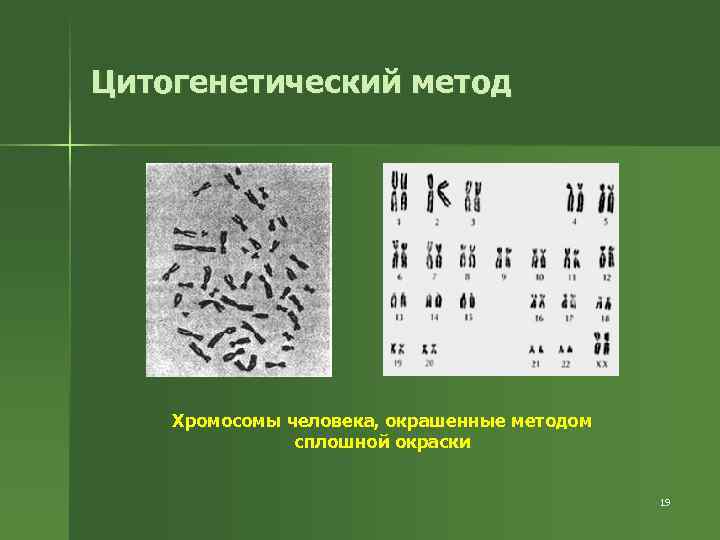 Цитогенетический метод Хромосомы человека, окрашенные методом сплошной окраски 19 