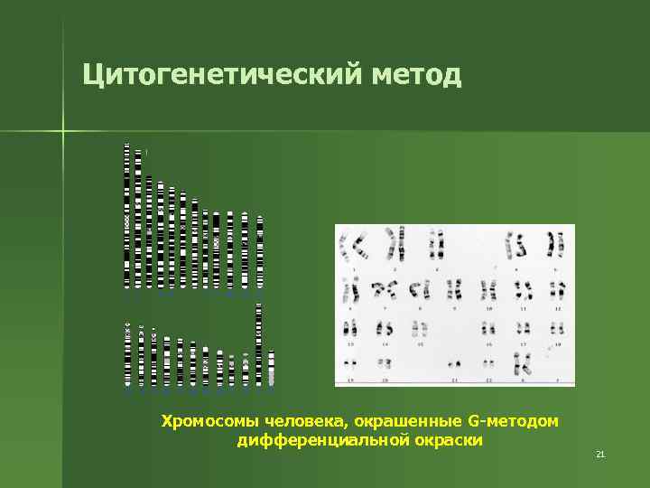 Цитогенетический метод Хромосомы человека, окрашенные G-методом дифференциальной окраски 21 