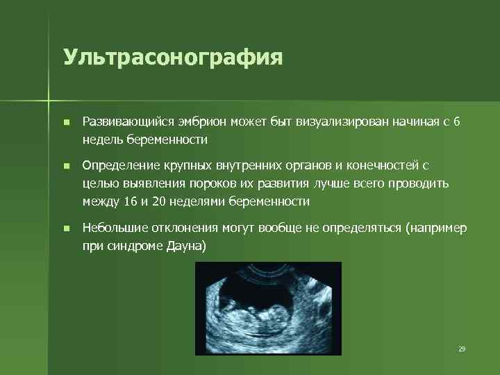 Ультрасонография n Развивающийся эмбрион может быт визуализирован начиная с 6 недель беременности n Определение