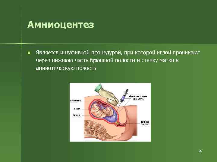 Амниоцентез n Является инвазивной процедурой, при которой иглой проникают через нижнюю часть брюшной полости