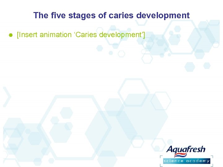 The five stages of caries development [Insert animation ‘Caries development’] 