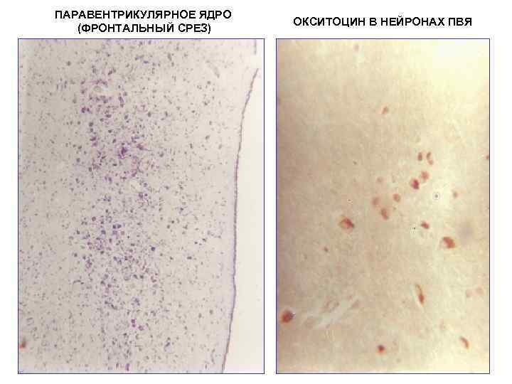 ПАРАВЕНТРИКУЛЯРНОЕ ЯДРО (ФРОНТАЛЬНЫЙ СРЕЗ) ОКСИТОЦИН В НЕЙРОНАХ ПВЯ 