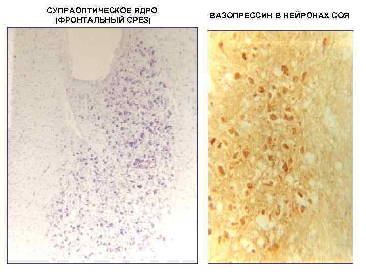 СУПРАОПТИЧЕСКОЕ ЯДРО (ФРОНТАЛЬНЫЙ СРЕЗ) ВАЗОПРЕССИН В НЕЙРОНАХ СОЯ 