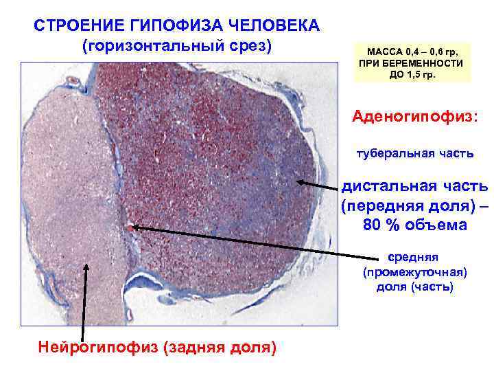 Гипофиз в разрезе фото