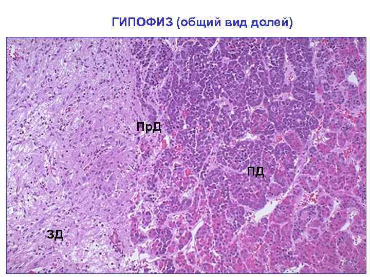 ГИПОФИЗ (общий вид долей) Пр. Д ПД ЗД 