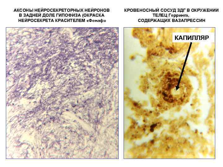 АКСОНЫ НЕЙРОСЕКРЕТОРНЫХ НЕЙРОНОВ В ЗАДНЕЙ ДОЛЕ ГИПОФИЗА (ОКРАСКА НЕЙРОСЕКРЕТА КРАСИТЕЛЕМ «Фенаф» КРОВЕНОСНЫЙ СОСУД ЗДГ