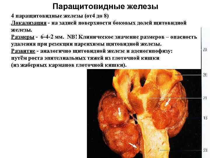 Паращитовидные железы 4 паращитовидные железы (от4 до 8) Локализация - на задней поверхности боковых