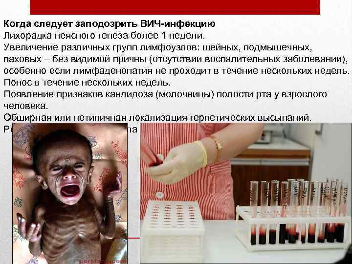 Когда следует заподозрить ВИЧ-инфекцию Лихорадка неясного генеза более 1 недели. Увеличение различных групп лимфоузлов: