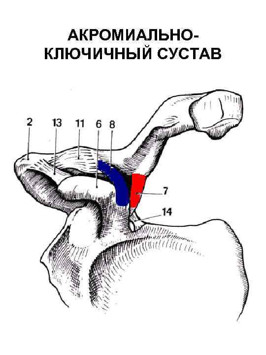 Дегенеративные изменения ключично акромиального сустава