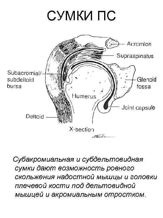 СУМКИ ПС Субакромиальная и субдельтовидная сумки дают возможность ровного скольжения надостной мышцы и головки
