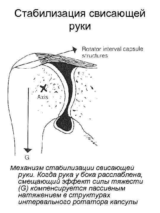 Стабилизация свисающей руки Механизм стабилизации свисающей руки. Когда рука у бока расслаблена, смещающий эффект
