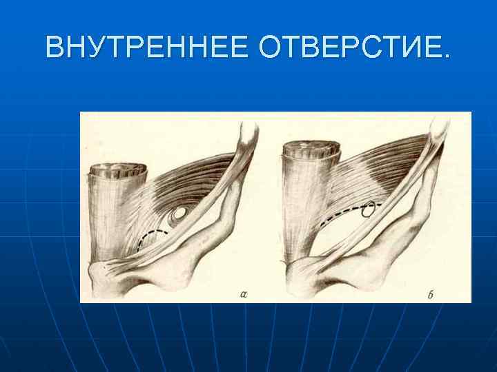 ВНУТРЕННЕЕ ОТВЕРСТИЕ. 