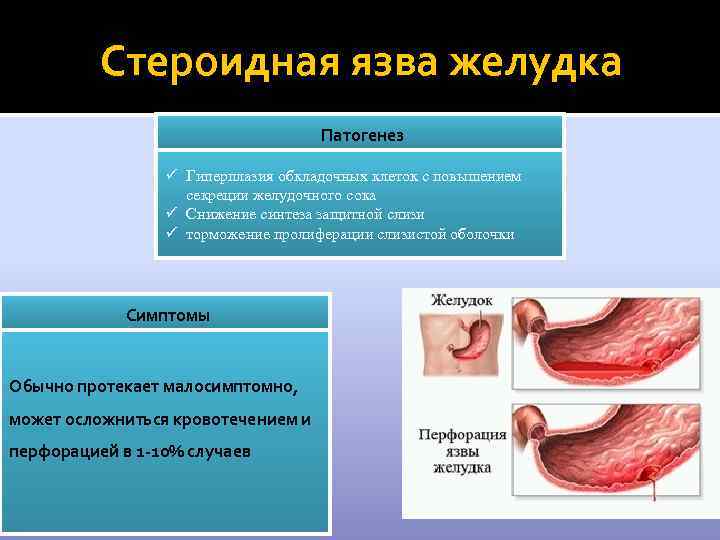 Стероидная язва желудка Патогенез ü Гиперплазия обкладочных клеток с повышением секреции желудочного сока ü