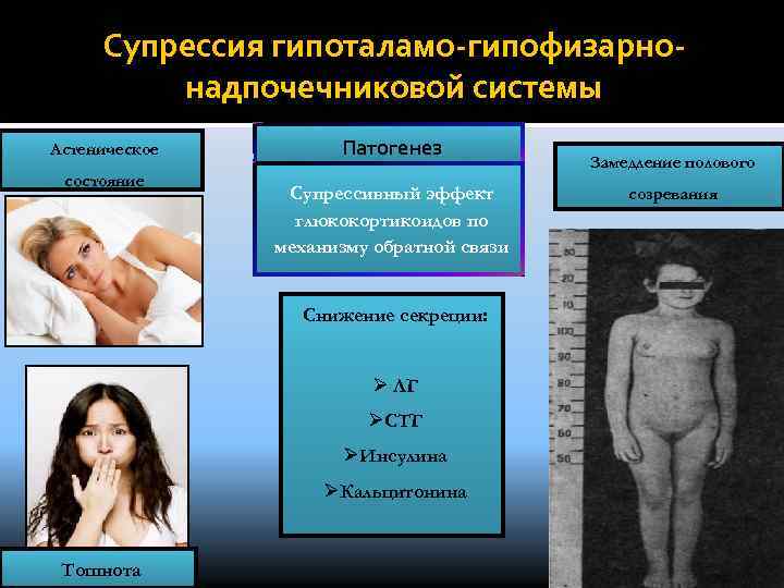 Супрессия гипоталамо-гипофизарнонадпочечниковой системы Астеническое состояние Патогенез Супрессивный эффект глюкокортикоидов по механизму обратной связи Снижение