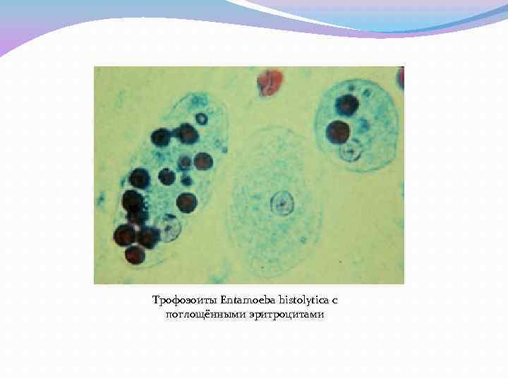 Трофозоиты Entamoeba histolytica с поглощёнными эритроцитами 