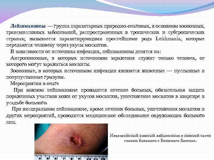 Лейшманиозы — группа паразитарных природно-очаговых, в основном зоонозных, трансмиссивных заболеваний, распространенных в тропических и