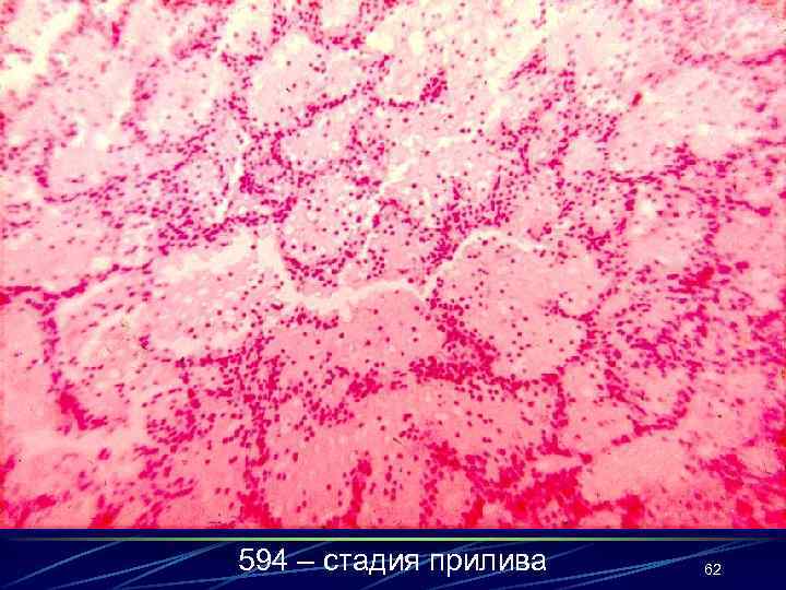 594 – стадия прилива 62 